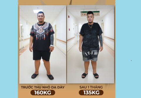 Người đàn ông nặng 156kg giảm cân thành công nhờ phẫu thuật thu nhỏ dạ dày giảm béo